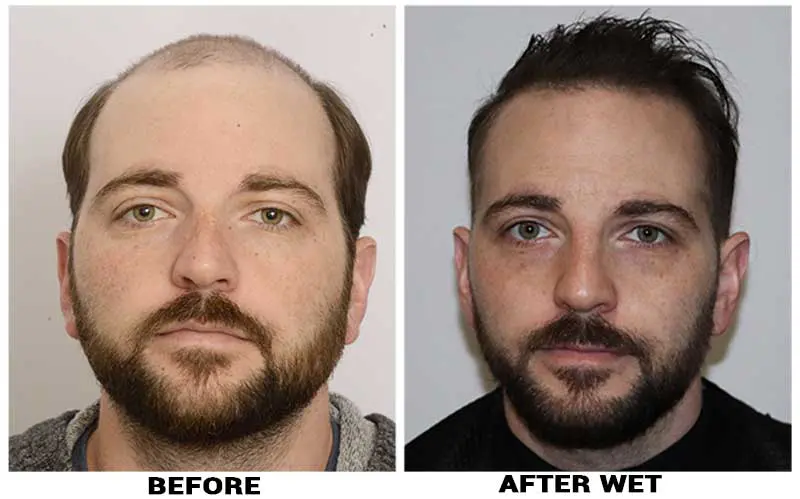 patient-pue-before-after-front-wet.webp