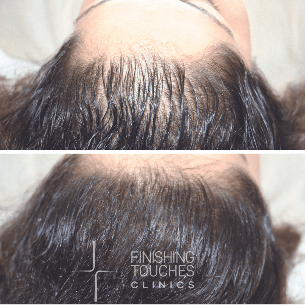 SMP-finishingtouches