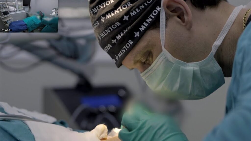 Αποτελέσματα μεταμόσχευσης μαλλιών με την τεχνική AVA FUE από τον Δρ. Ζάρεβ