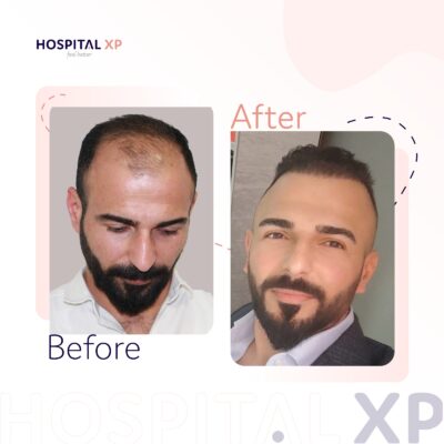 XP Hospital, Instabul