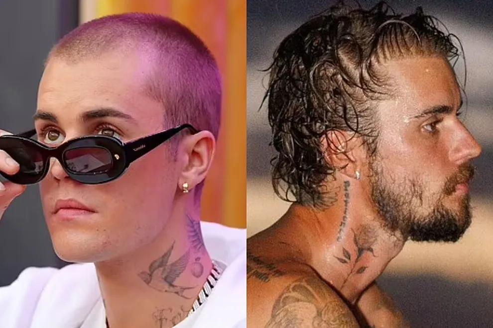 bieber justin hair transplant