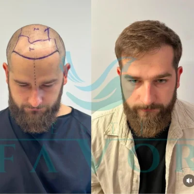 Este Favor, Κωνσταντινούπολη