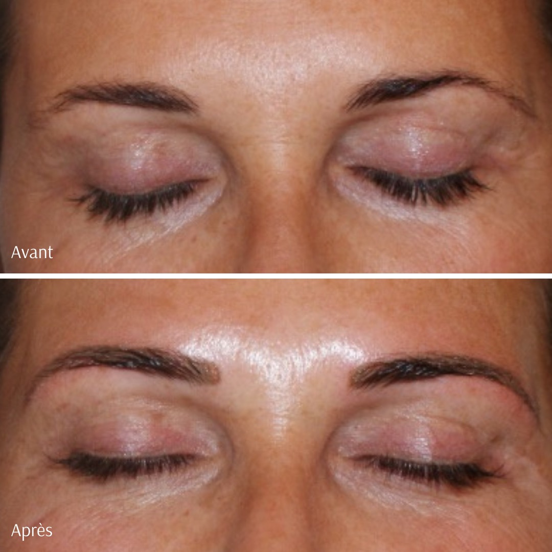 Aslan-medical-before-after