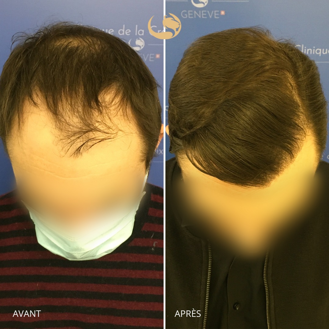 Aslan-medical-before-after