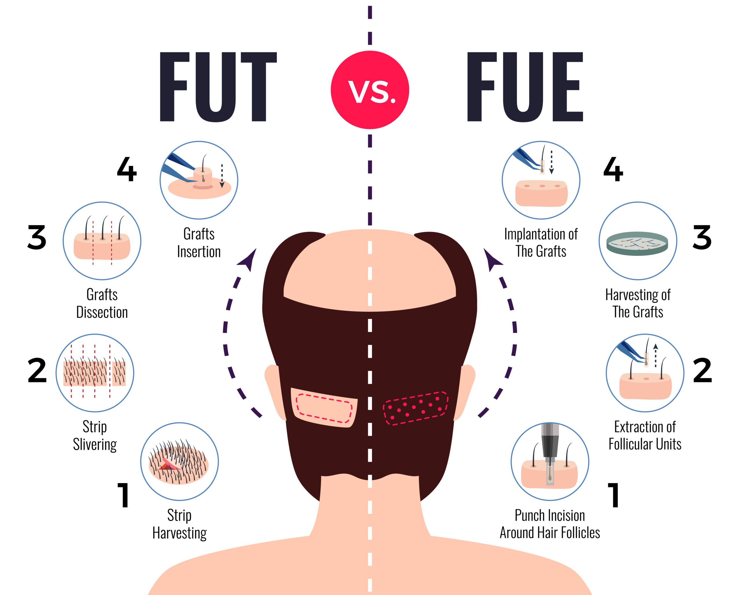FUT VS DHI