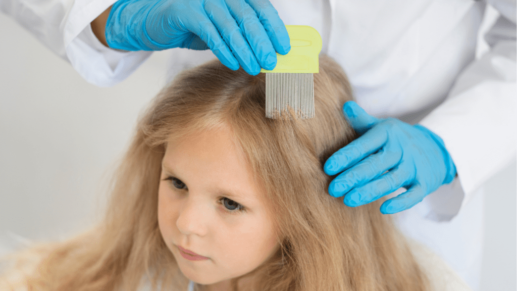 Alopecia Areata Patch on Child’s Scalp