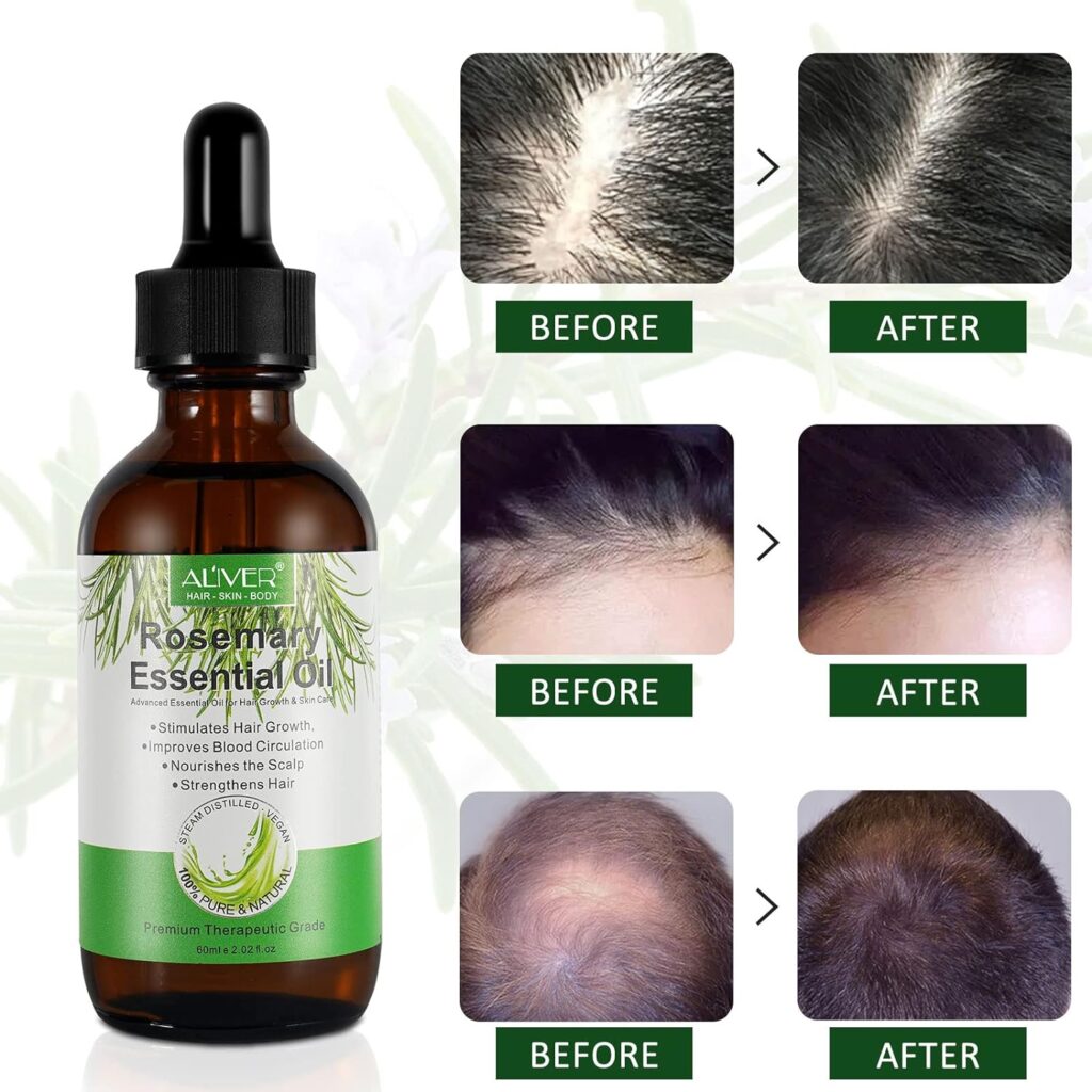 Organic Rosemary Oil – Scalp and Hair Growth