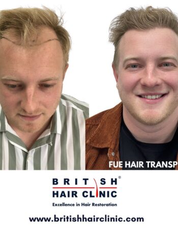 British Hair Clinics, Brentwood