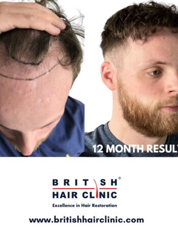 British Hair Clinics, Brentwood