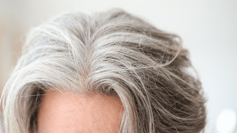 hair repigmentation treatment for white patches