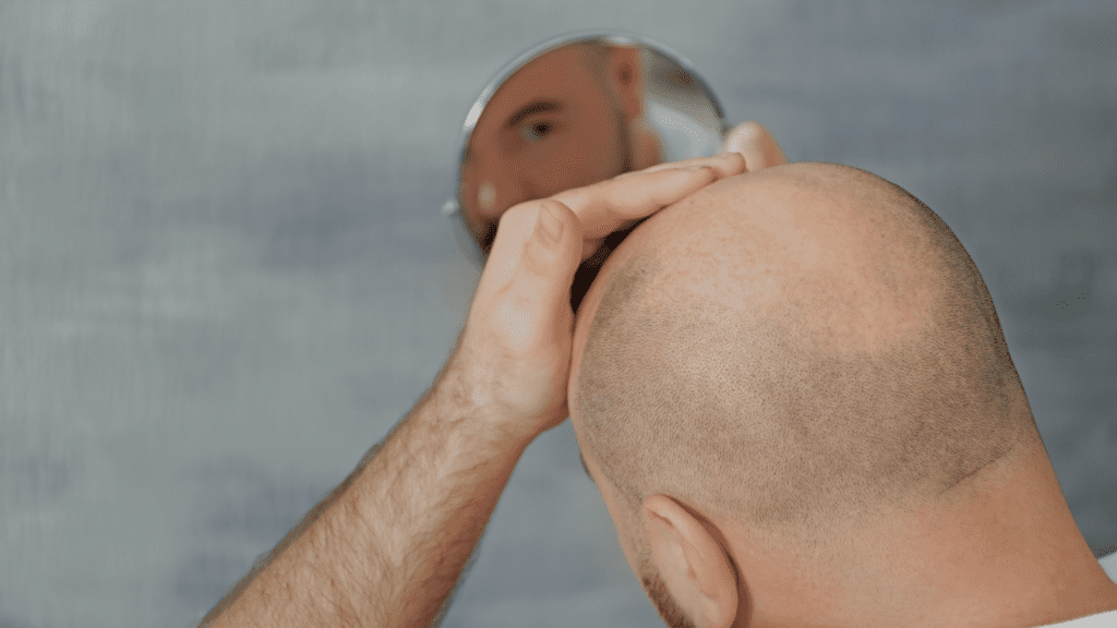 hairline-vs-crown