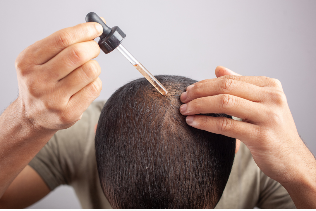 minoxidil-dermaroller