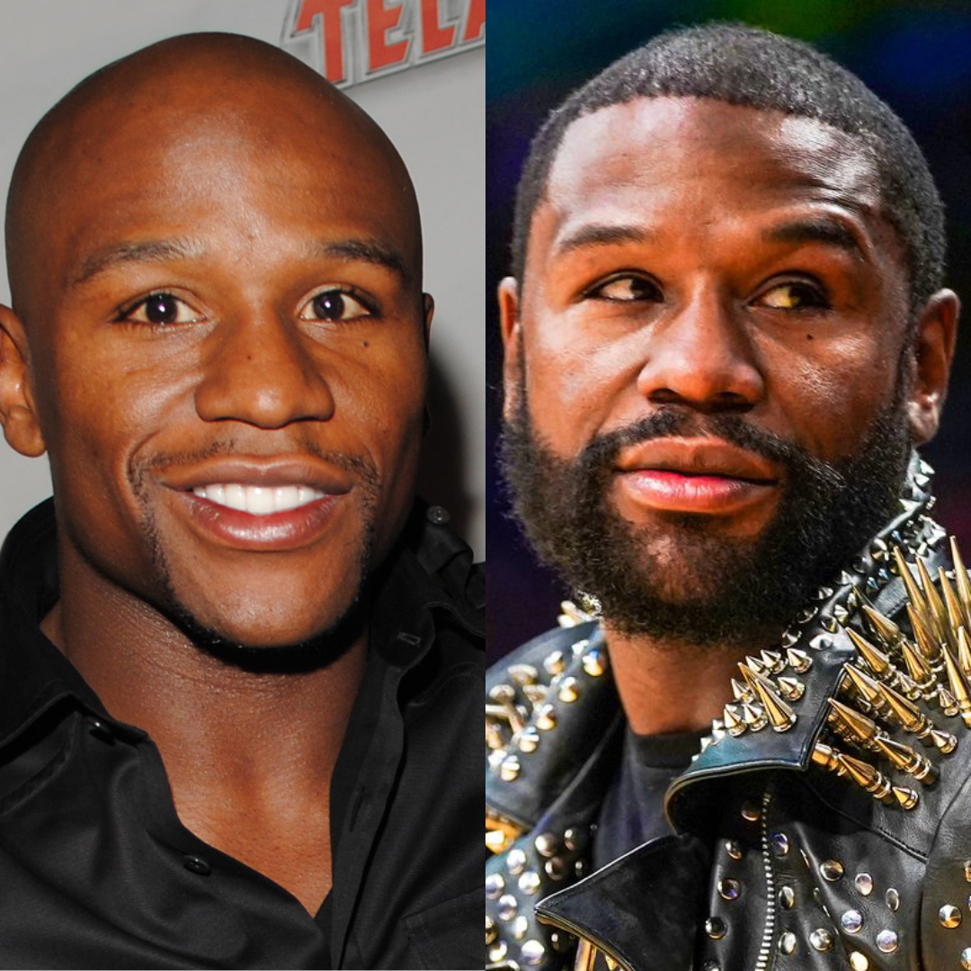 Floyd Mayweather A Boxing Icon and His Battle with Hair Loss