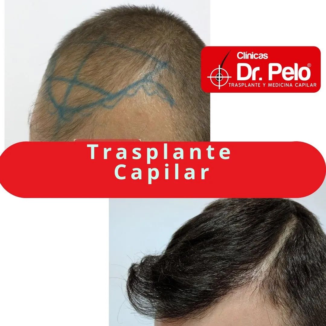 Dr Pelo-Clinics-result-1