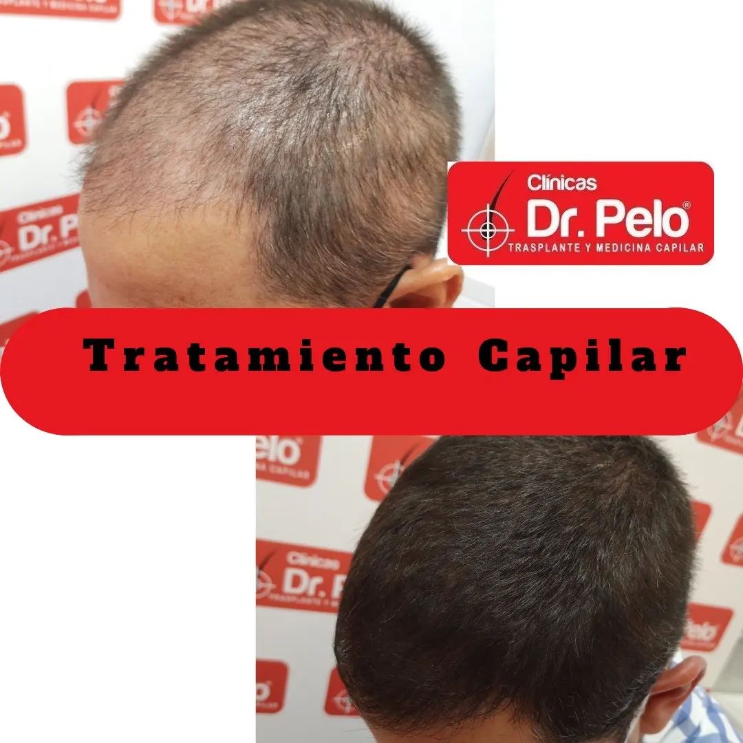 Dr Pelo-Clinics-result-2