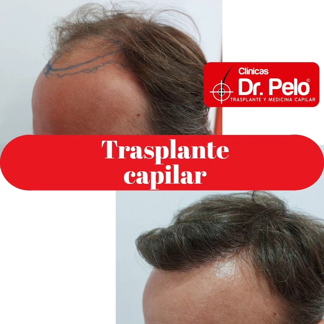 Dr Pelo-Clinics-result-3