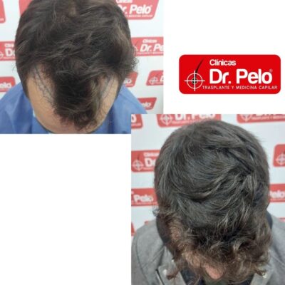Dr Pelo Clinics, Sevilla