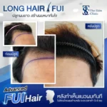 before-after-dr-top