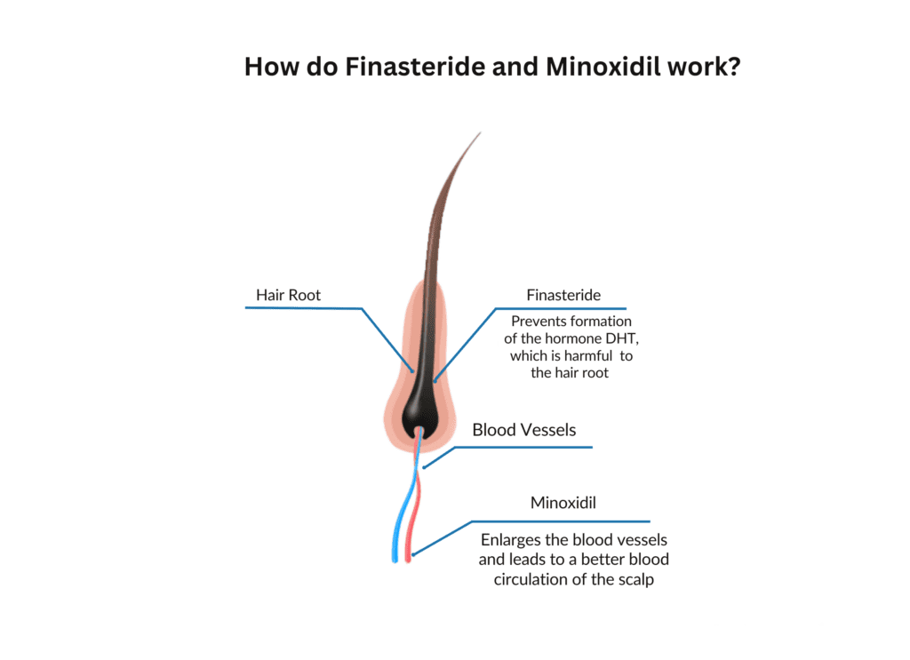 how-do-finasteride-and-minoxidil-work