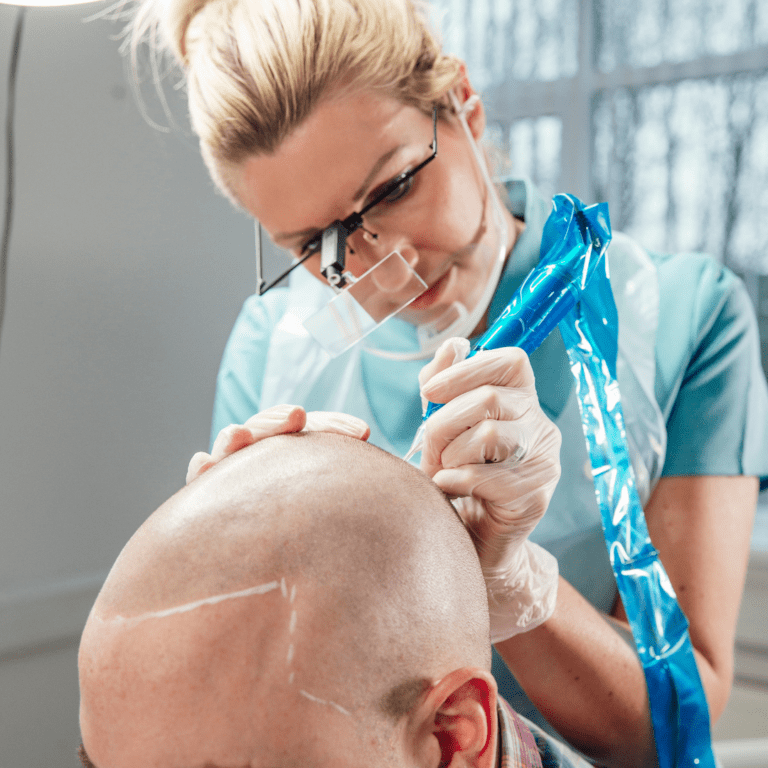 scalp-micropigmentation