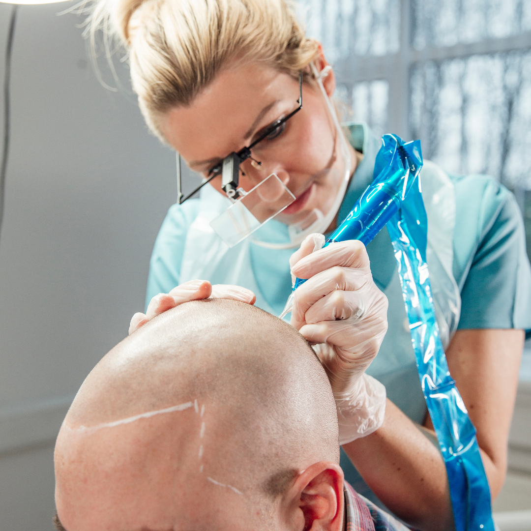 scalp-micropigmentation