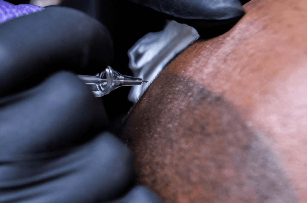 scalp-micropigmentation