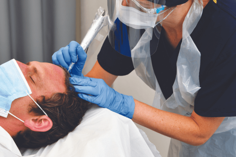 Scalp Micropigmentation Density Procedure Male