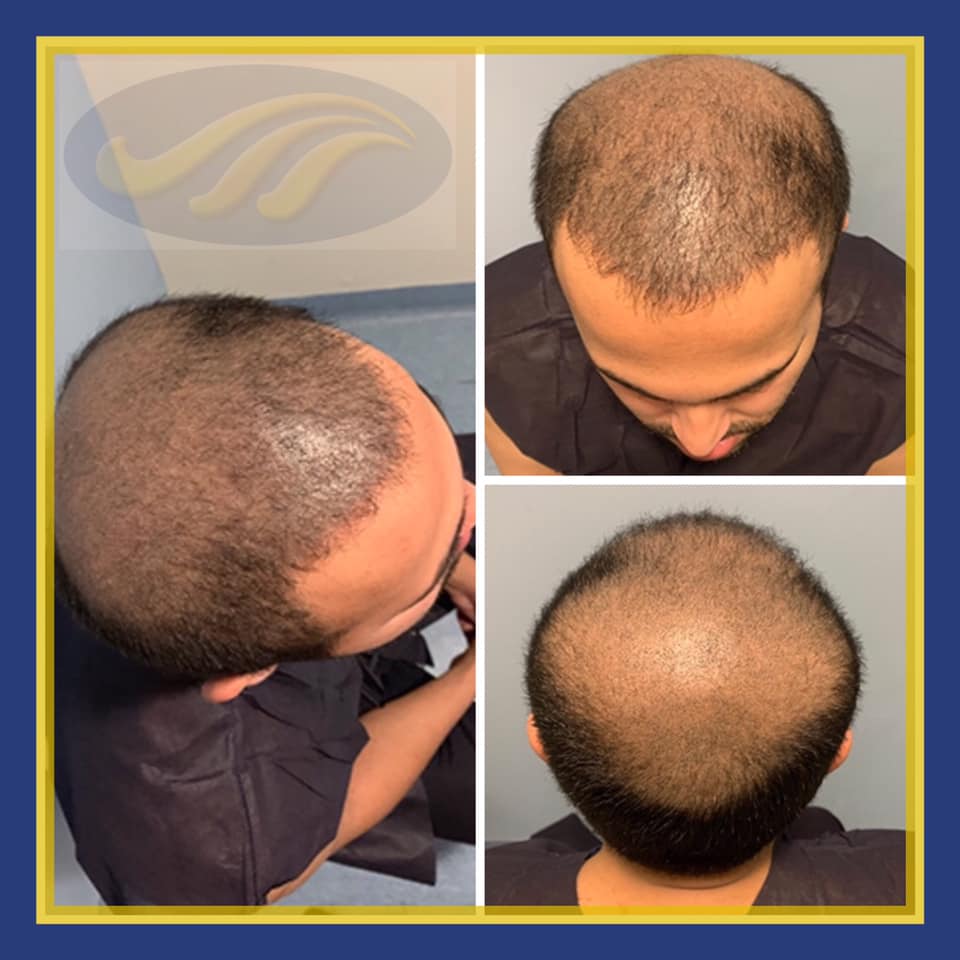 The-Knudsen-Clinic-result 1