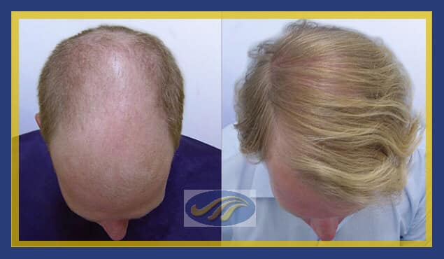 The-Knudsen-Clinic-result 3