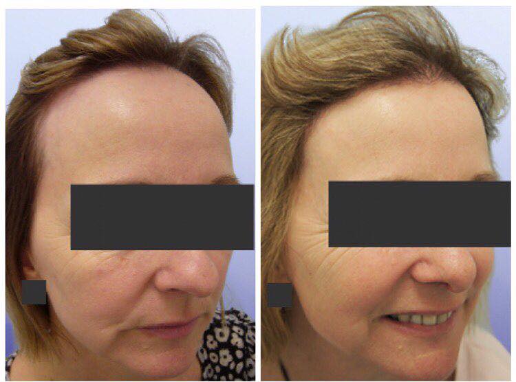 The-Knudsen-Clinic-result 6