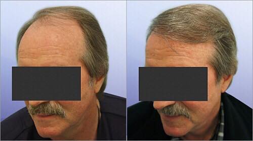The-Knudsen-Clinic-result 7