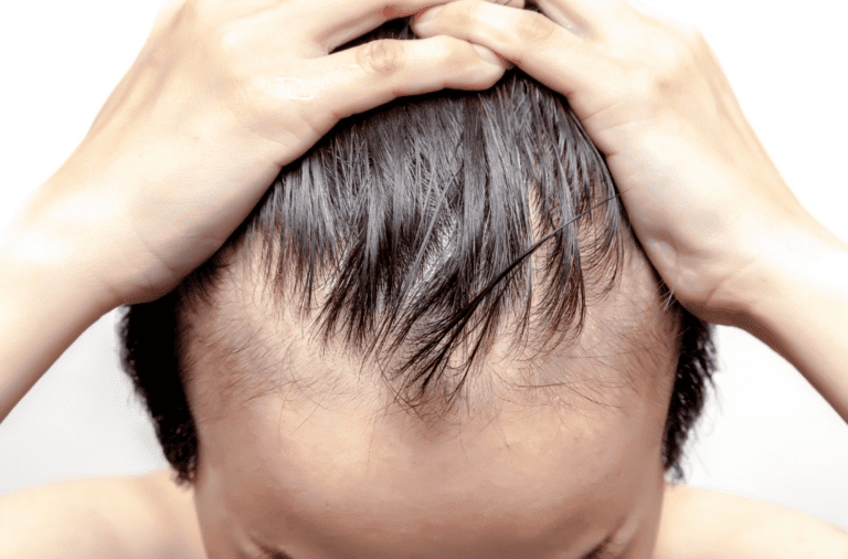 widows peak