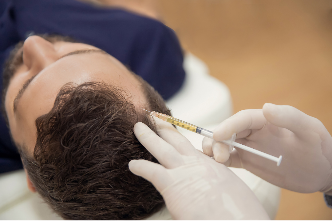 prp-treatment