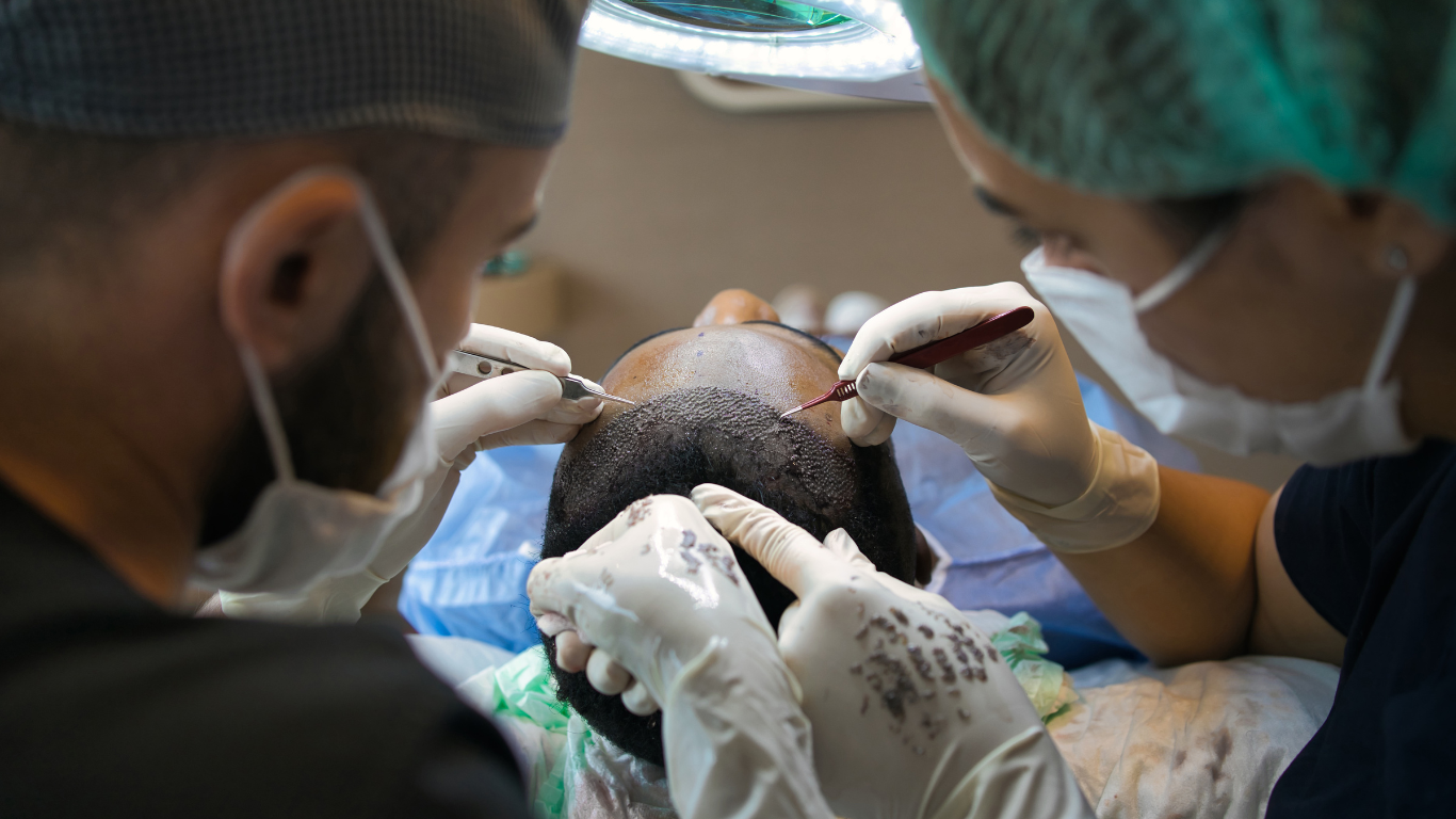 Best Afro Hair Transplant Surgeons in Turkey 2026