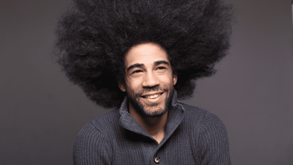 Afro Hair Transplant Results