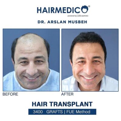Dr Arslan, HAIRMEDICO, Istanbul