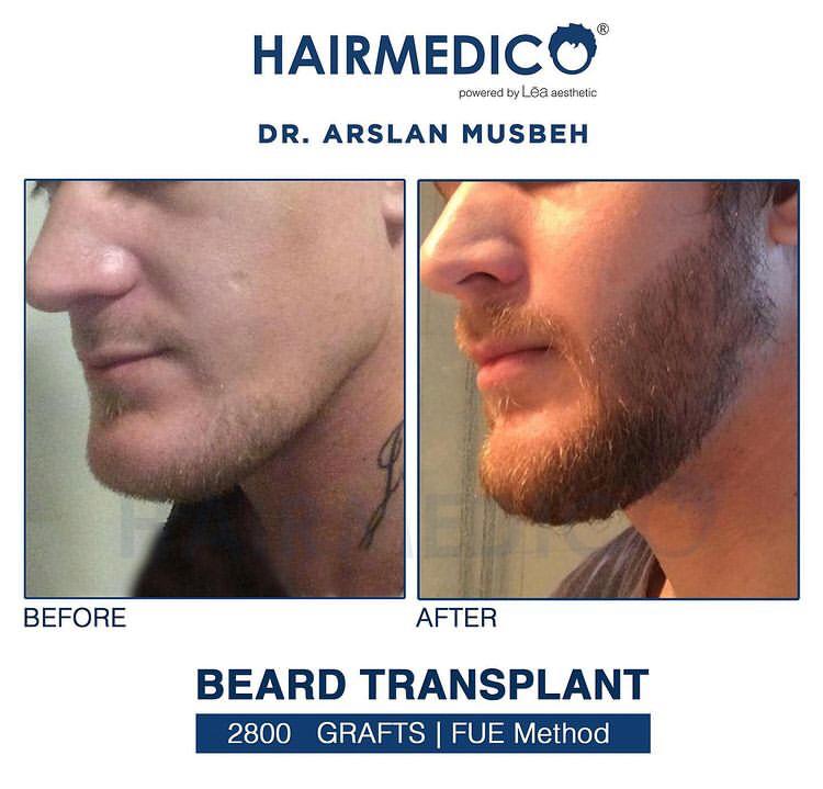 HAIRMEDICO