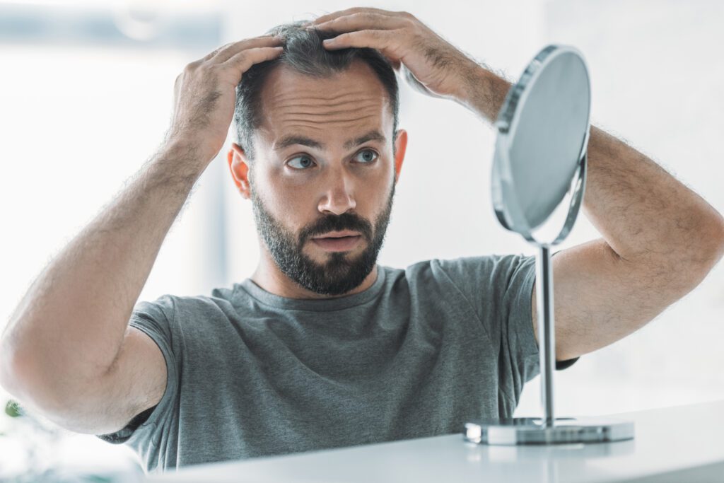 Countries with the Most Bald Men