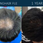 long-fue-bangkok