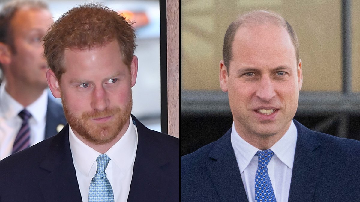 harry-and-william-hairloss