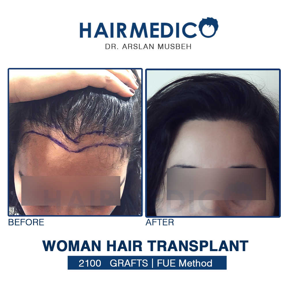 HAIRMEDICO