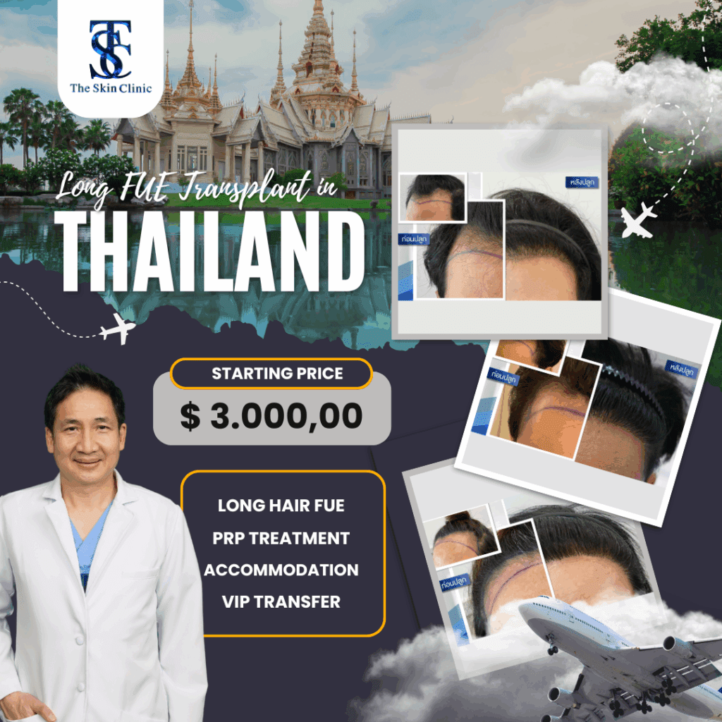 Hair transplant in Thailand by The Skin Clinic – $3,000 all-inclusive Long Hair FUE package with PRP, accommodation, and VIP transfer.
