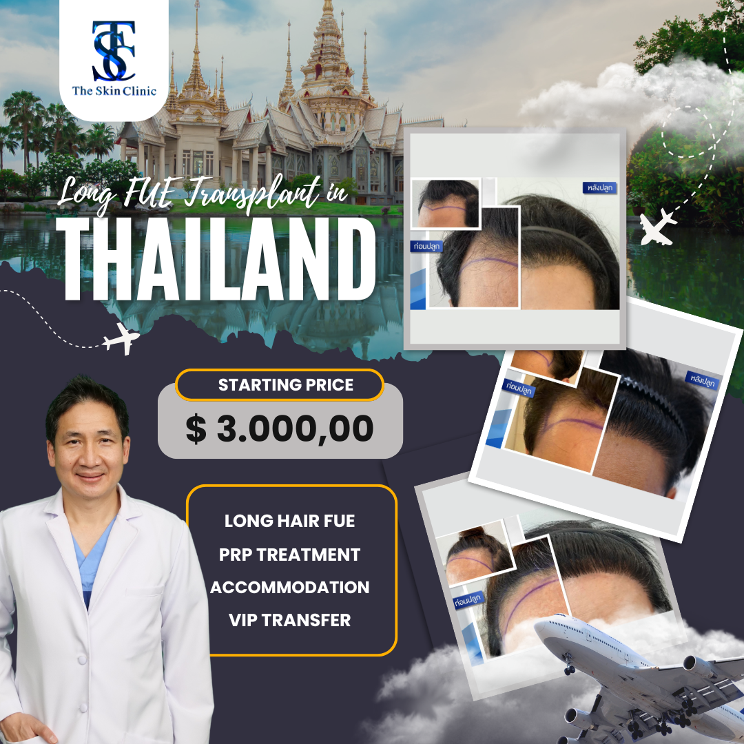 Hair transplant in Thailand by The Skin Clinic – $3,000 all-inclusive Long Hair FUE package with PRP, accommodation, and VIP transfer.