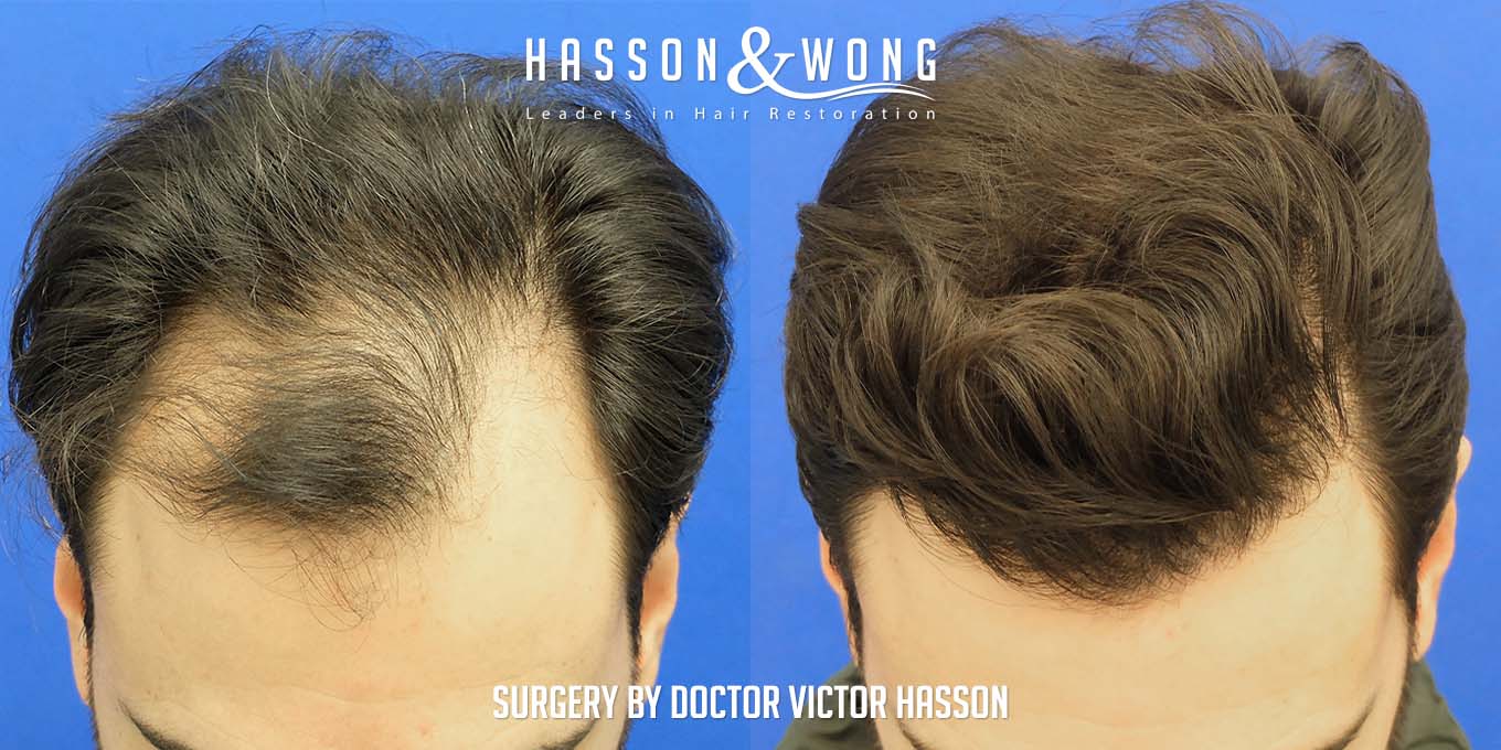 Hasson&Wong-result