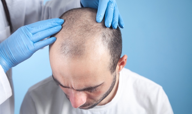 dermatological-examination-hair-loss