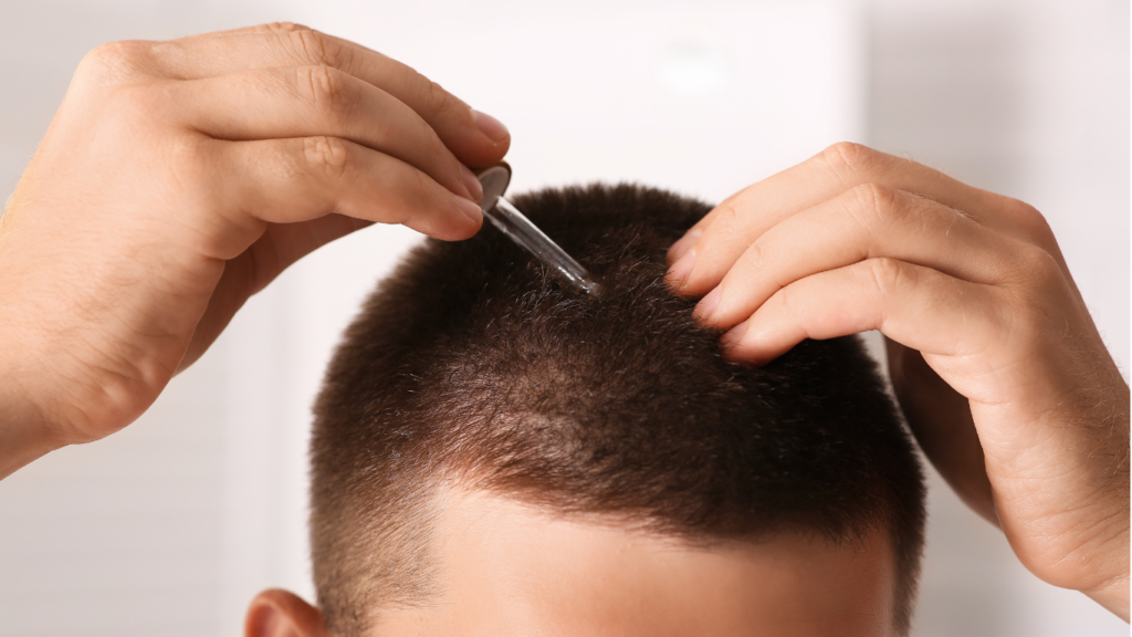 Hair density improving six months after hair transplant treatment 