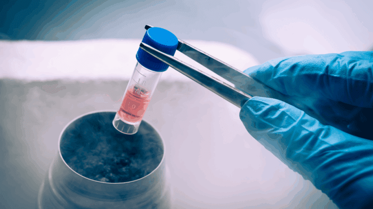 Close-up of a syringe filled with stem cell-rich nanofat being prepared for scalp injection in a regenerative hair treatment.