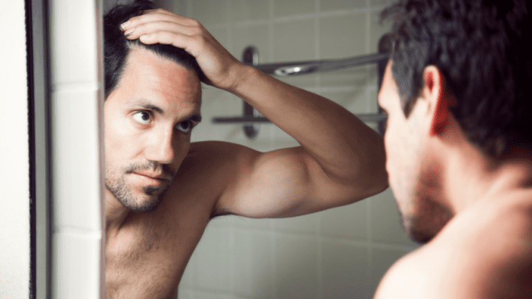Receding-Hairline
