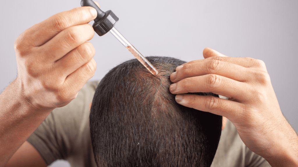 minoxidil
