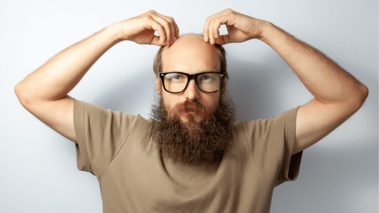 Top 3 Reasons Why Hair Transplants Fail